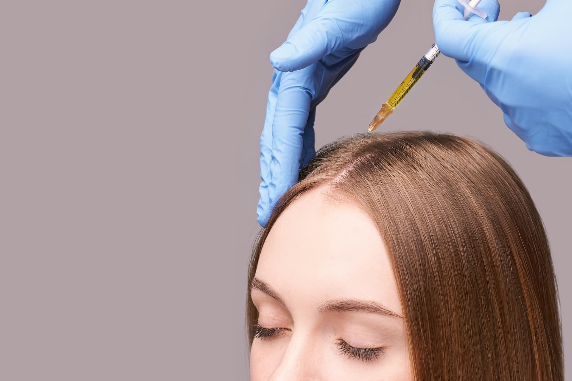 PRP Treatment Delray Beach- FL 33483 – Hair Restoration - Best Hair Loss  Treatment – PRP Injections Delray Beach - PRP Injections Boynton - PRP  Injections Boca Raton - PRP Injections Coconut